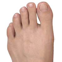 Противогрибковая серия Antifungal